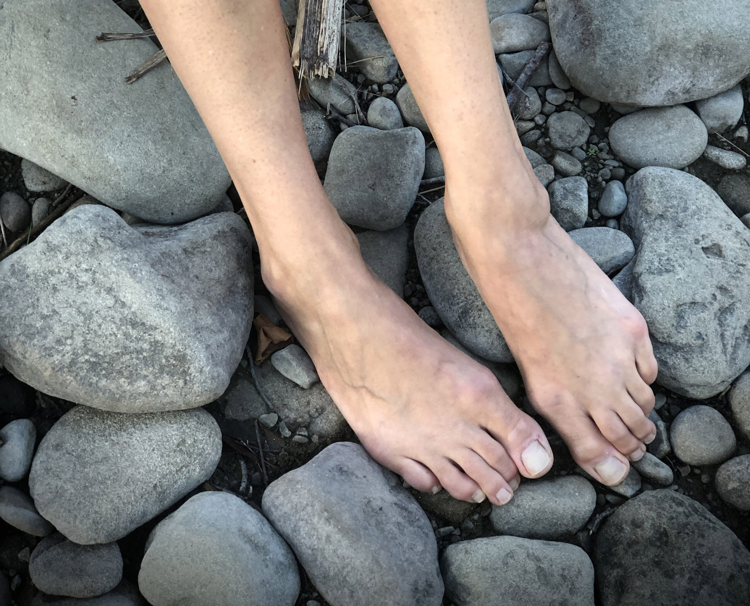 feet, rocks